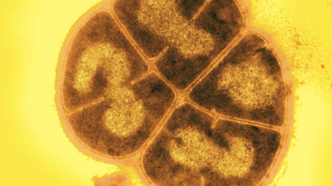 Deinococcus radiodurans